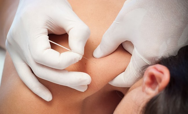 acupuntura osteovital